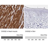 Anti-CASQ2 antibody produced in rabbit Prestige Antibodies® Powered by Atlas Antibodies, affinity isolated antibody, buffered aqueous glycerol solution