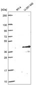 Anti-Cd1C Antibody Produced In Rabbit Prestige Antibodies® Powered by Atlas Antibodies, affinity isolated antibody, buffered aqueous glycerol solution