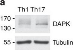 Anti-β-Tubulin Antibody, clone AA2 clone AA2, Upstate®, from mouse