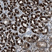 Anti-SRM antibody produced in rabbit Prestige Antibodies® Powered by Atlas Antibodies, affinity isolated antibody, buffered aqueous glycerol solution