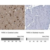 Anti-YARS antibody produced in rabbit Prestige Antibodies® Powered by Atlas Antibodies, affinity isolated antibody, buffered aqueous glycerol solution