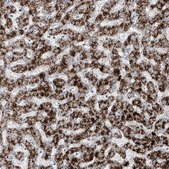 Anti-ABCD3 antibody produced in rabbit Prestige Antibodies® Powered by Atlas Antibodies, affinity isolated antibody, buffered aqueous glycerol solution