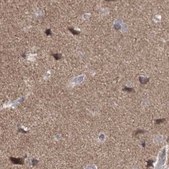 Anti-PDS5A antibody produced in rabbit Prestige Antibodies® Powered by Atlas Antibodies, affinity isolated antibody, buffered aqueous glycerol solution