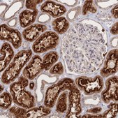 Anti-LRP5 antibody produced in rabbit Prestige Antibodies® Powered by Atlas Antibodies, affinity isolated antibody, buffered aqueous glycerol solution