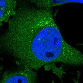 Anti-CHPF antibody produced in rabbit Prestige Antibodies® Powered by Atlas Antibodies, affinity isolated antibody, buffered aqueous glycerol solution