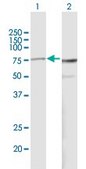 Anti-PES1 antibody produced in mouse IgG fraction of antiserum, buffered aqueous solution