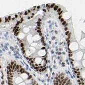Anti-ZBTB7B antibody produced in rabbit Prestige Antibodies® Powered by Atlas Antibodies, affinity isolated antibody, buffered aqueous glycerol solution, Ab1
