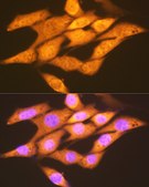 Anti-FGF1 Antibody, clone 3X3E5, Rabbit Monoclonal