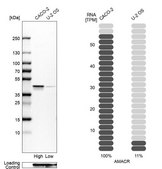 Anti-AMACR antibody produced in rabbit affinity isolated antibody, buffered aqueous glycerol solution