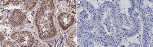 Anti-Vimentin Antibody, clone LN-6 culture supernatant, clone LN-6, Chemicon®