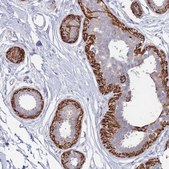 Anti-ERBIN antibody produced in rabbit Prestige Antibodies® Powered by Atlas Antibodies, affinity isolated antibody, buffered aqueous glycerol solution