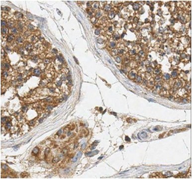 Anti-Rab5A Antibody, clone 7D8.1 clone 7D8.1, from mouse