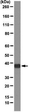 Anti-SBP-tag Antibody, clone 20 | MAB10764 clone 20, 1.0&#160;mg/mL, from mouse