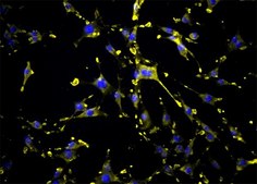 OSUMMER.6 Mouse NRAS-Mutant Melanoma Cell Line