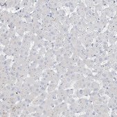 Anti-B3GNT7 antibody produced in rabbit Prestige Antibodies® Powered by Atlas Antibodies, affinity isolated antibody, buffered aqueous glycerol solution