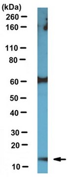 Anti-ARMS2 Antibody from rabbit, purified by affinity chromatography