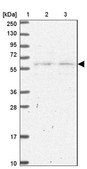 Anti-SLC25A23 antibody produced in rabbit Prestige Antibodies® Powered by Atlas Antibodies, affinity isolated antibody, buffered aqueous glycerol solution