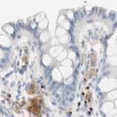 Anti-MANEA antibody produced in rabbit Ab1, Prestige Antibodies® Powered by Atlas Antibodies, affinity isolated antibody, buffered aqueous glycerol solution