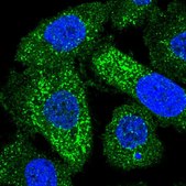 Anti-FAM43A antibody produced in rabbit Prestige Antibodies® Powered by Atlas Antibodies, affinity isolated antibody, buffered aqueous glycerol solution