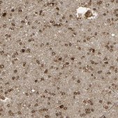 Anti-CANX antibody produced in rabbit Ab1, Prestige Antibodies® Powered by Atlas Antibodies, affinity isolated antibody, buffered aqueous glycerol solution