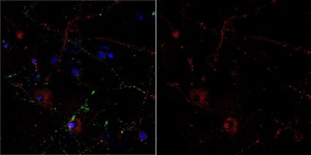 Anti-Metabotropic Glutamate Receptor 5 Antibody, Alexa Fluor&#8482; 555 from rabbit, ALEXA FLUOR&#8482; 555
