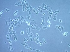 N27-A Rat Dopaminergic Neural Cell Line N27-A rat dopaminergic neural cell line is a suitable model for Parkinson’s disease research.