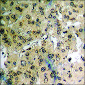 Anti-phospho-FHIT (pTyr114) antibody produced in rabbit affinity isolated antibody