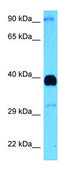 Anti-ADIPOR1 (C-terminal) antibody produced in rabbit affinity isolated antibody