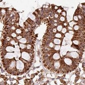 Anti-ATP5A1 antibody produced in rabbit Prestige Antibodies® Powered by Atlas Antibodies, affinity isolated antibody, buffered aqueous glycerol solution
