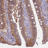Anti-AHCYL1 antibody produced in rabbit Prestige Antibodies® Powered by Atlas Antibodies, affinity isolated antibody, buffered aqueous glycerol solution