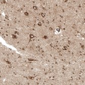 Anti-PREX1 antibody produced in rabbit Prestige Antibodies® Powered by Atlas Antibodies, affinity isolated antibody, buffered aqueous glycerol solution