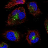 Anti-VAMP7 antibody produced in rabbit Prestige Antibodies® Powered by Atlas Antibodies, affinity isolated antibody, buffered aqueous glycerol solution