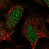 Anti-ARMCX6 antibody produced in rabbit Prestige Antibodies® Powered by Atlas Antibodies, affinity isolated antibody, buffered aqueous glycerol solution