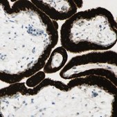 Anti-GDF15 antibody produced in rabbit Prestige Antibodies® Powered by Atlas Antibodies, affinity isolated antibody, buffered aqueous glycerol solution