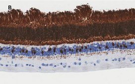 Anti-Recoverin Antibody, clone 1J23, ZooMAb® Rabbit Monoclonal recombinant, expressed in HEK 293 cells