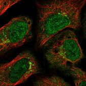 Anti-GCC2 antibody produced in rabbit Prestige Antibodies® Powered by Atlas Antibodies, affinity isolated antibody, buffered aqueous glycerol solution