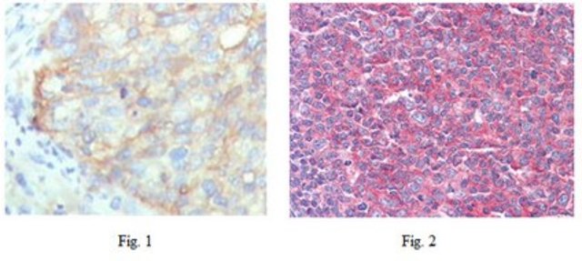 Anti-KARS Antibody, clone 8G12C1 ascites fluid, clone 8G12C1, from mouse