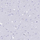 Anti-FKBP11 antibody produced in rabbit Prestige Antibodies® Powered by Atlas Antibodies, affinity isolated antibody, buffered aqueous glycerol solution