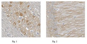 Anti-ZNF423 Antibody from rabbit, purified by affinity chromatography