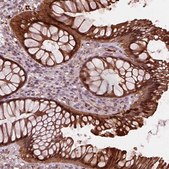 Anti-SRI antibody produced in rabbit Prestige Antibodies® Powered by Atlas Antibodies, affinity isolated antibody
