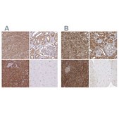 Anti-PACSIN2 antibody produced in rabbit Prestige Antibodies® Powered by Atlas Antibodies, affinity isolated antibody, buffered aqueous glycerol solution
