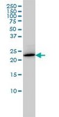 Monoclonal Anti-RAB6A antibody produced in mouse clone 3G3, purified immunoglobulin, buffered aqueous solution