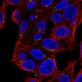 Anti-MASP2 antibody produced in rabbit Prestige Antibodies® Powered by Atlas Antibodies, affinity isolated antibody, buffered aqueous glycerol solution
