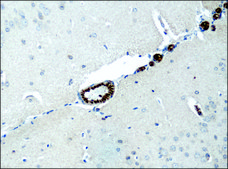 Anti-Destrin/ADF (GV-13) antibody produced in rabbit affinity isolated antibody, buffered aqueous solution