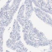 Anti-KRT15 antibody produced in rabbit Prestige Antibodies® Powered by Atlas Antibodies, affinity isolated antibody, buffered aqueous glycerol solution