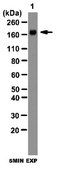 Anti-WNK4 Antibody from rabbit, purified by affinity chromatography