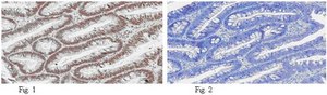 Anti-Replication Protein A Antibody, clone RPA34-20 clone RPA34-20, from mouse