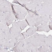 Anti-SUPT16H antibody produced in rabbit Prestige Antibodies® Powered by Atlas Antibodies, affinity isolated antibody, buffered aqueous glycerol solution