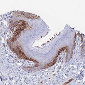 Anti-SLC2A1 antibody produced in rabbit affinity isolated antibody, buffered aqueous glycerol solution