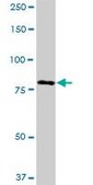 Anti-ADARB1 antibody produced in mouse purified immunoglobulin, buffered aqueous solution